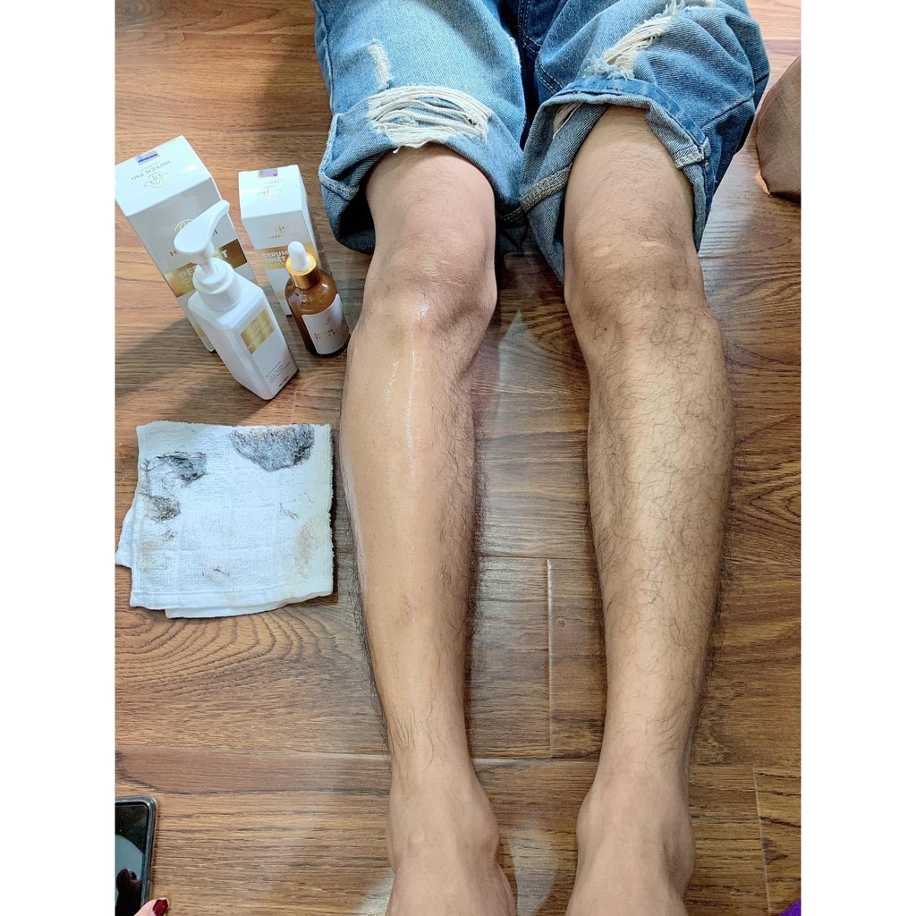 Combo triệt lông huyền phi